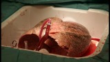 Transplantasjonsforskning: Kan vasking av griselunger gi mindre avstøtning?